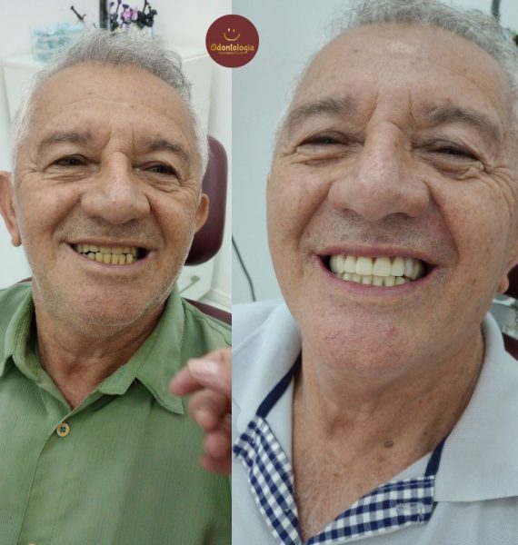 Próteses